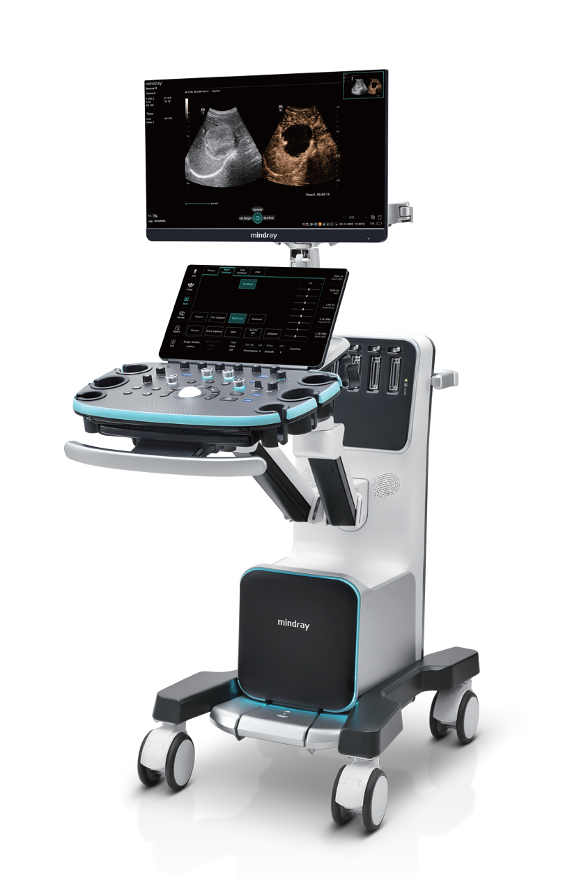 Resona I9 Premium Diagnostic Ultrasound System - ZST+ Platform - Revolutionary ultrasound evolution with channel data processing